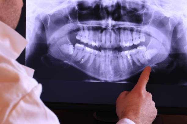 Best Broken or Chipped Tooth Repair in Stone Ridge, VA